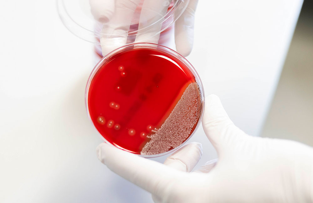 Staphylococcus aureus_Sarah Kossmann